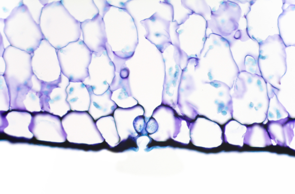 Feuille d'Aloes - détail d'un stomate CT x100